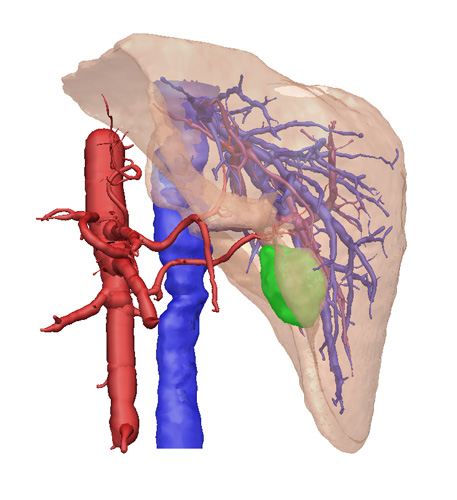 3D Liver1