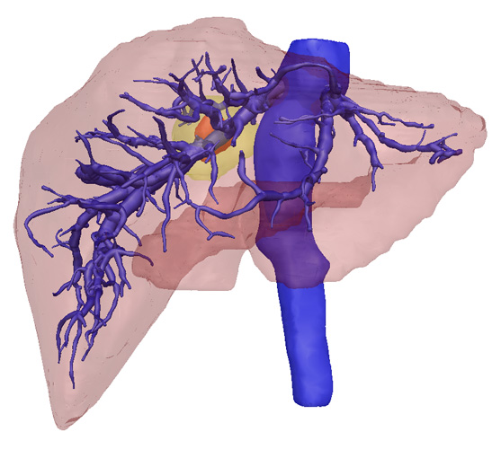 3D Liver2